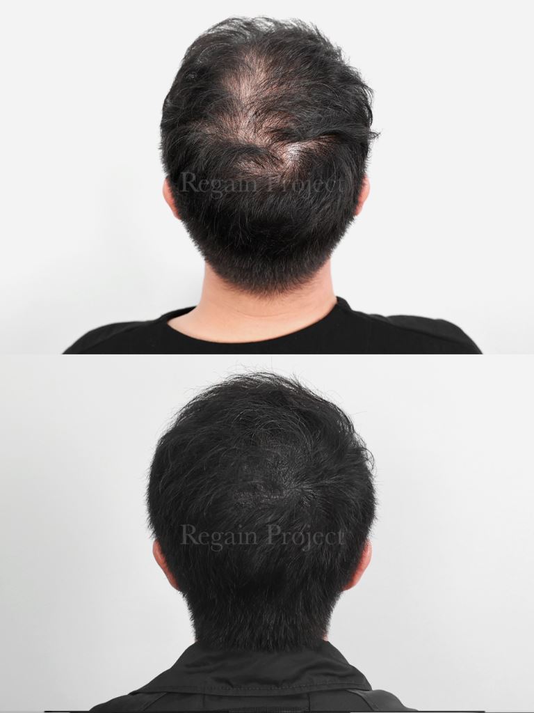 Regain Portfolio 8