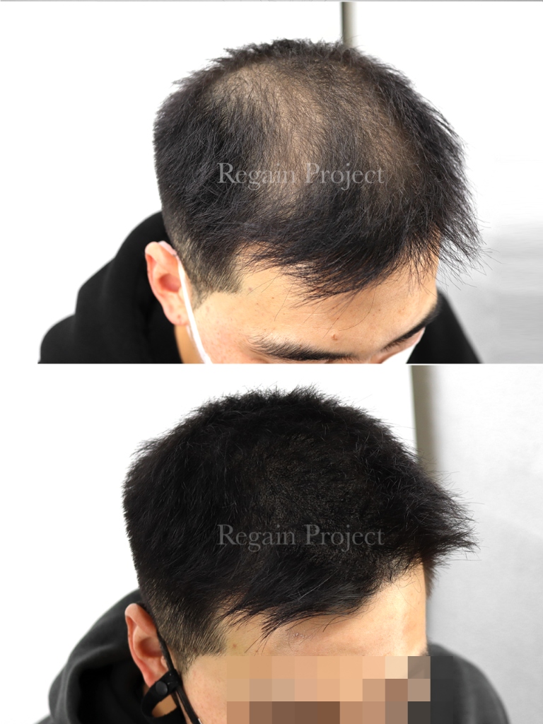 Regain Portfolio 19